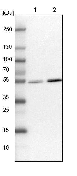 UMPS Antibody - BSA Free Western Blot: UMPS Antibody - BSA Free [NBP1-85896]