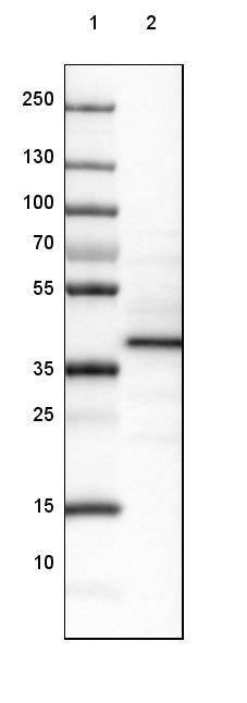 LMOD3 Antibody - BSA Free Western Blot: LMOD3 Antibody - BSA Free [NBP1-85898]