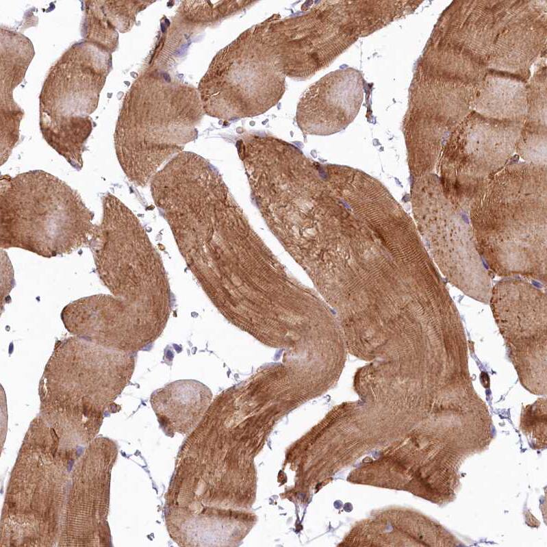 LMOD3 Antibody - BSA Free Immunohistochemistry-Paraffin: LMOD3 Antibody - BSA Free [NBP1-85898]