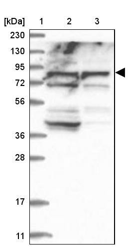 ACOX3 Antibody - BSA Free Western Blot: ACOX3 Antibody - BSA Free [NBP1-85900]