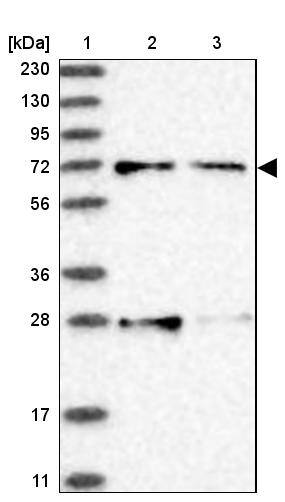 ACOX3 Antibody - BSA Free Western Blot: ACOX3 Antibody - BSA Free [NBP1-85901]