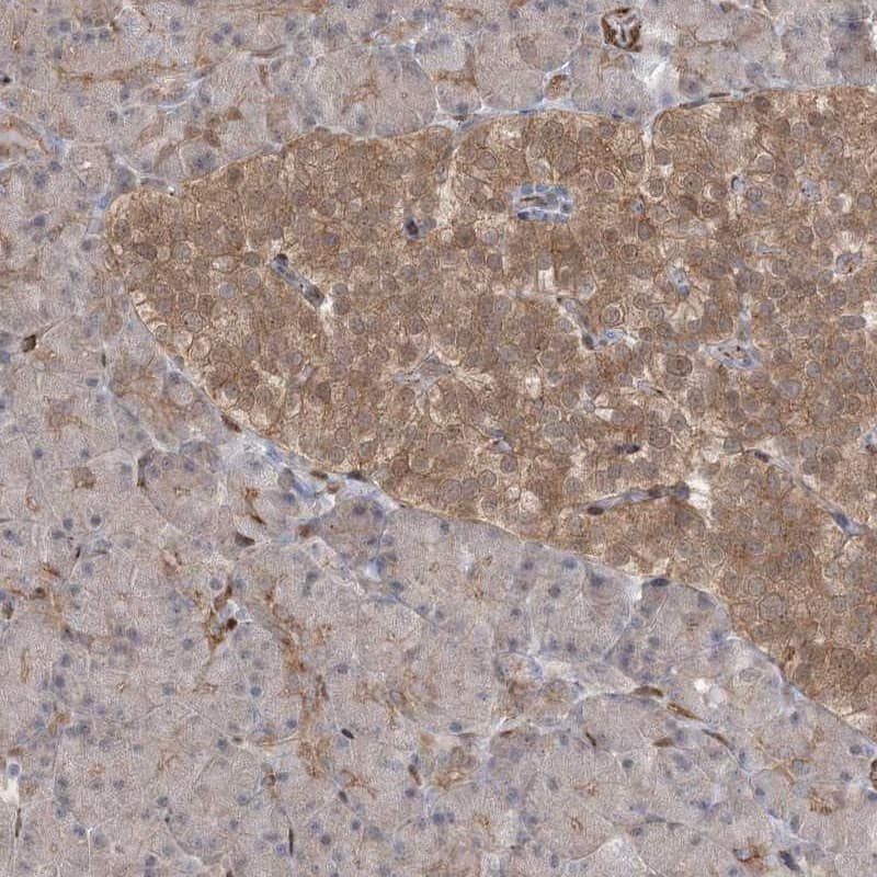 RIN1 Antibody - BSA Free Immunohistochemistry-Paraffin: RIN1 Antibody [NBP1-85905]