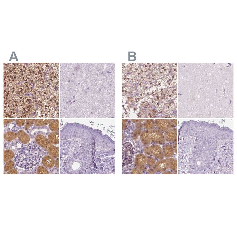GALM Antibody - BSA Free Immunohistochemistry-Paraffin: GALM Antibody - BSA Free [NBP1-85906]