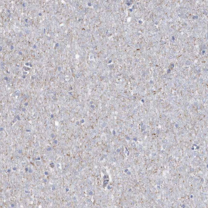 Rab17 Antibody - BSA Free Immunohistochemistry-Paraffin: Rab17 Antibody - BSA Free [NBP1-85910]