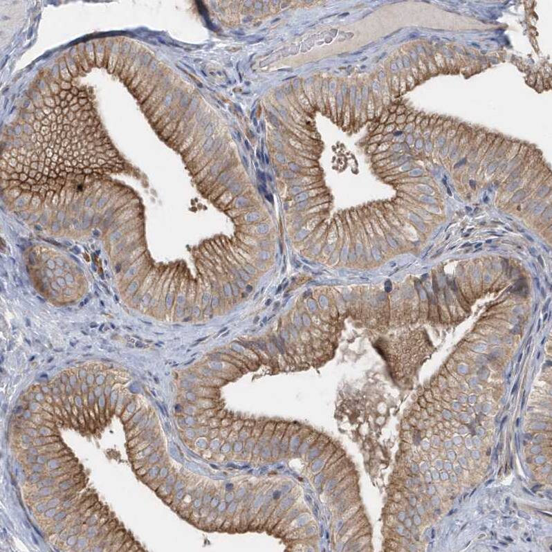 Rab17 Antibody - BSA Free Immunohistochemistry-Paraffin: Rab17 Antibody - BSA Free [NBP1-85910]