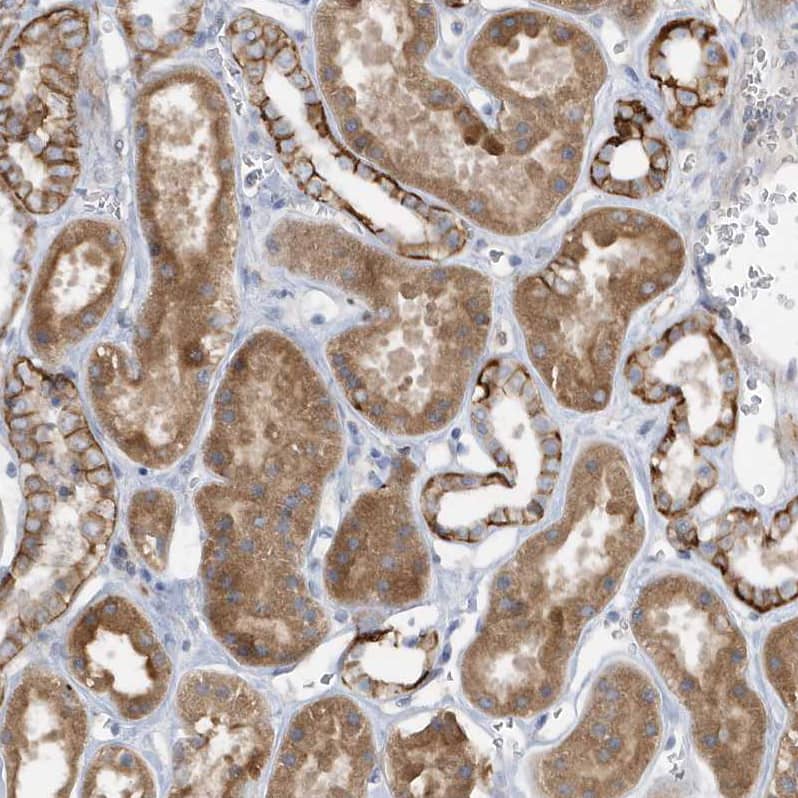 Rab17 Antibody - BSA Free Immunohistochemistry-Paraffin: Rab17 Antibody - BSA Free [NBP1-85910]