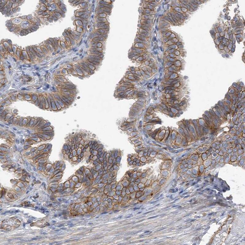 Rab17 Antibody - BSA Free Immunohistochemistry-Paraffin: Rab17 Antibody - BSA Free [NBP1-85910]