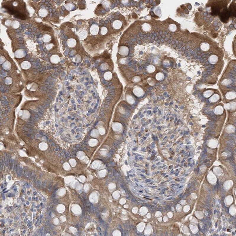 Rab17 Antibody - BSA Free Immunohistochemistry-Paraffin: Rab17 Antibody - BSA Free [NBP1-85910]