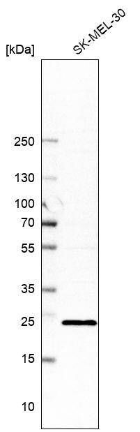 Rab17 Antibody - BSA Free Western Blot: Rab17 Antibody - BSA Free [NBP1-85910]