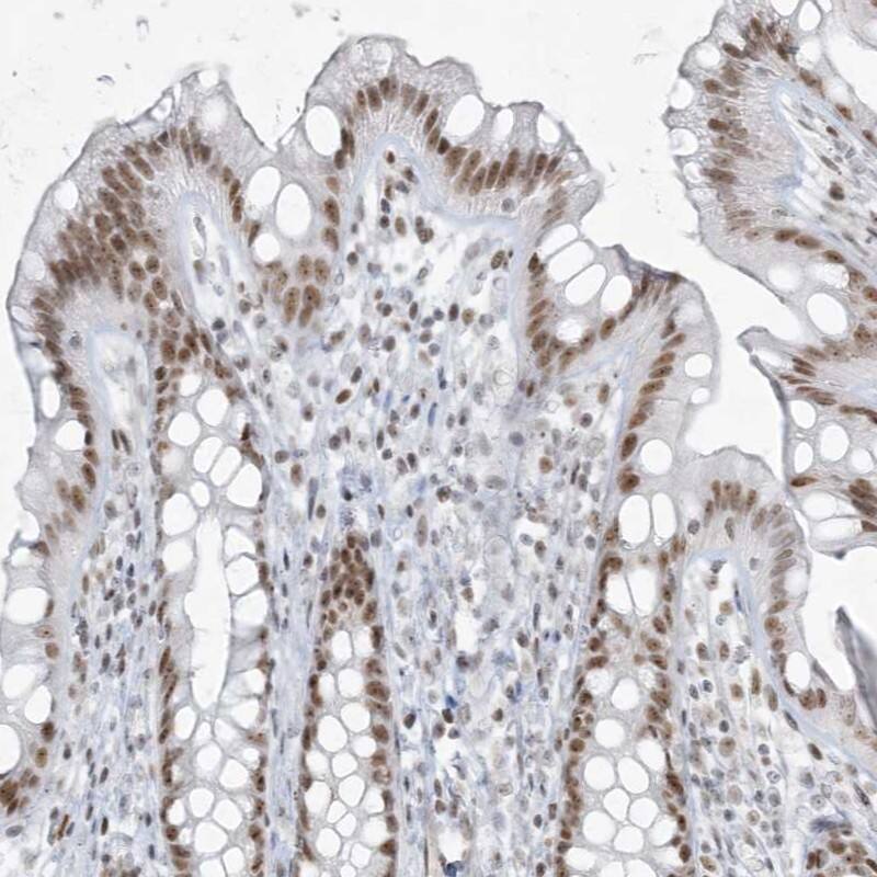 ZNF787 Antibody - BSA Free Immunohistochemistry-Paraffin: ZNF787 Antibody - BSA Free [NBP1-85911]