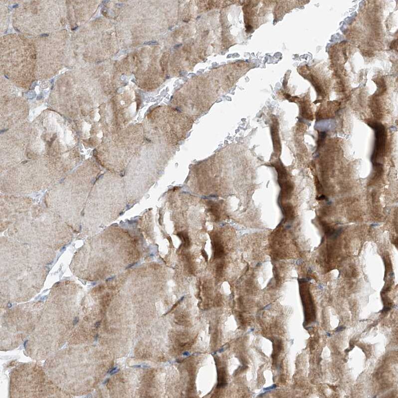 VAMP-5 Antibody - BSA Free Immunohistochemistry-Paraffin: VAMP-5 Antibody - BSA Free [NBP1-85913]