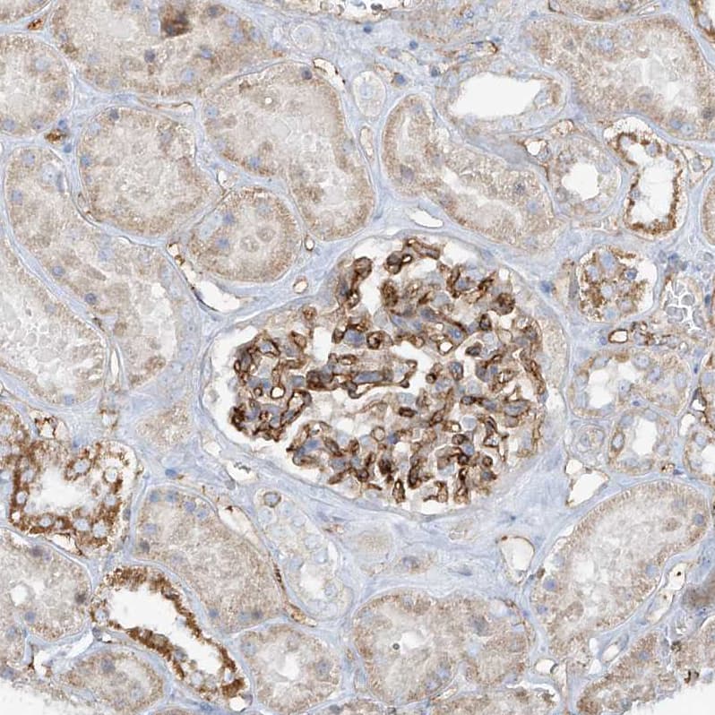 VAMP-5 Antibody - BSA Free Immunohistochemistry-Paraffin: VAMP-5 Antibody - BSA Free [NBP1-85913]