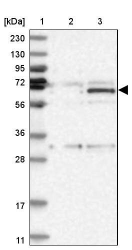 ZNF189 Antibody - BSA Free Western Blot: ZNF189 Antibody - BSA Free [NBP1-85915]