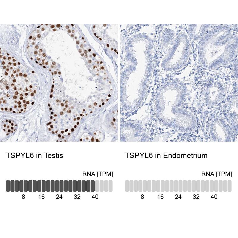 TSPYL6 Antibody - BSA Free Immunohistochemistry-Paraffin: TSPYL6 Antibody [NBP1-85917]