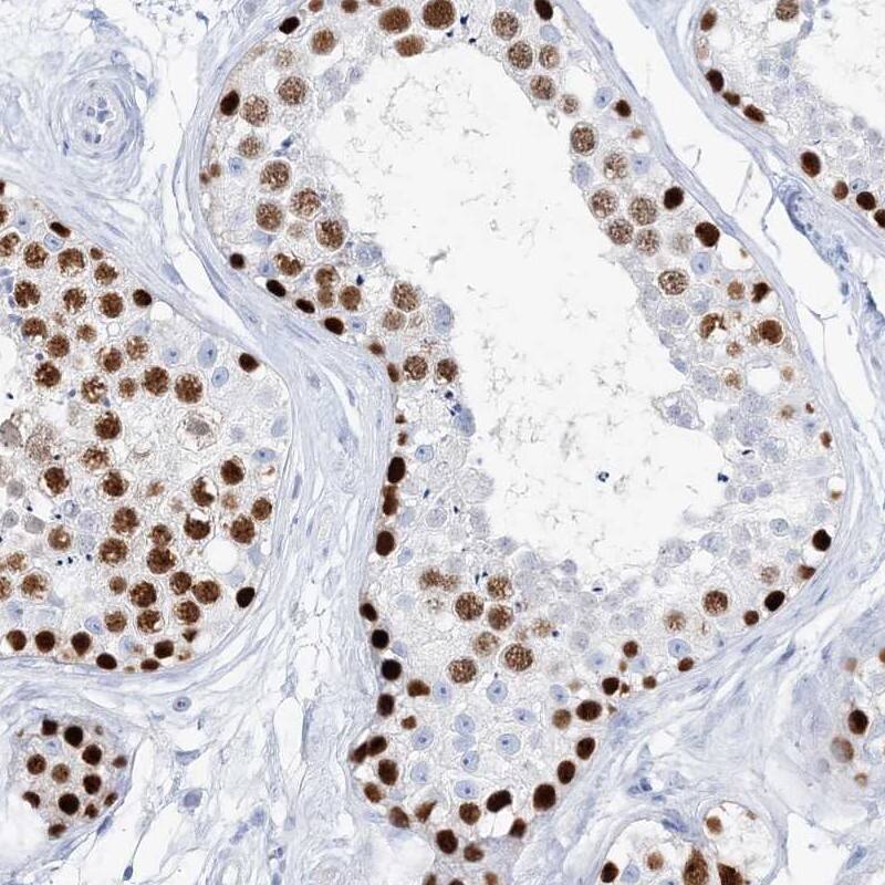 TSPYL6 Antibody - BSA Free Immunohistochemistry-Paraffin: TSPYL6 Antibody [NBP1-85917]