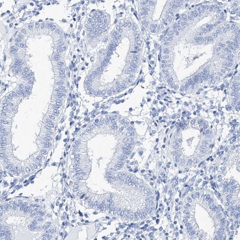 TSPYL6 Antibody - BSA Free Immunohistochemistry-Paraffin: TSPYL6 Antibody [NBP1-85917]