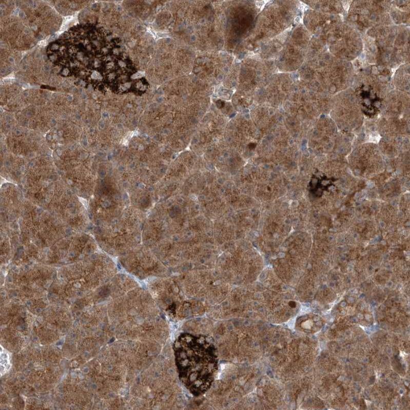 PDE11A Antibody - BSA Free Immunohistochemistry-Paraffin: PDE11A Antibody - BSA Free [NBP1-85919]