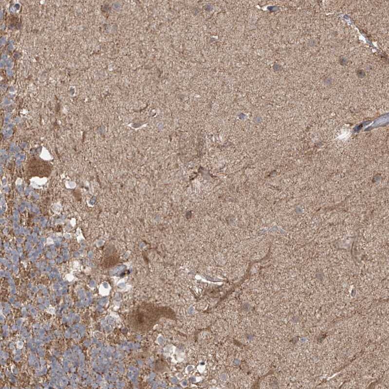 PDE11A Antibody - BSA Free Immunohistochemistry-Paraffin: PDE11A Antibody - BSA Free [NBP1-85919]