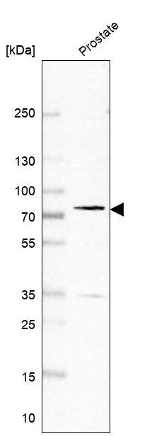 PDE11A Antibody - BSA Free Western Blot: PDE11A Antibody - BSA Free [NBP1-85919]