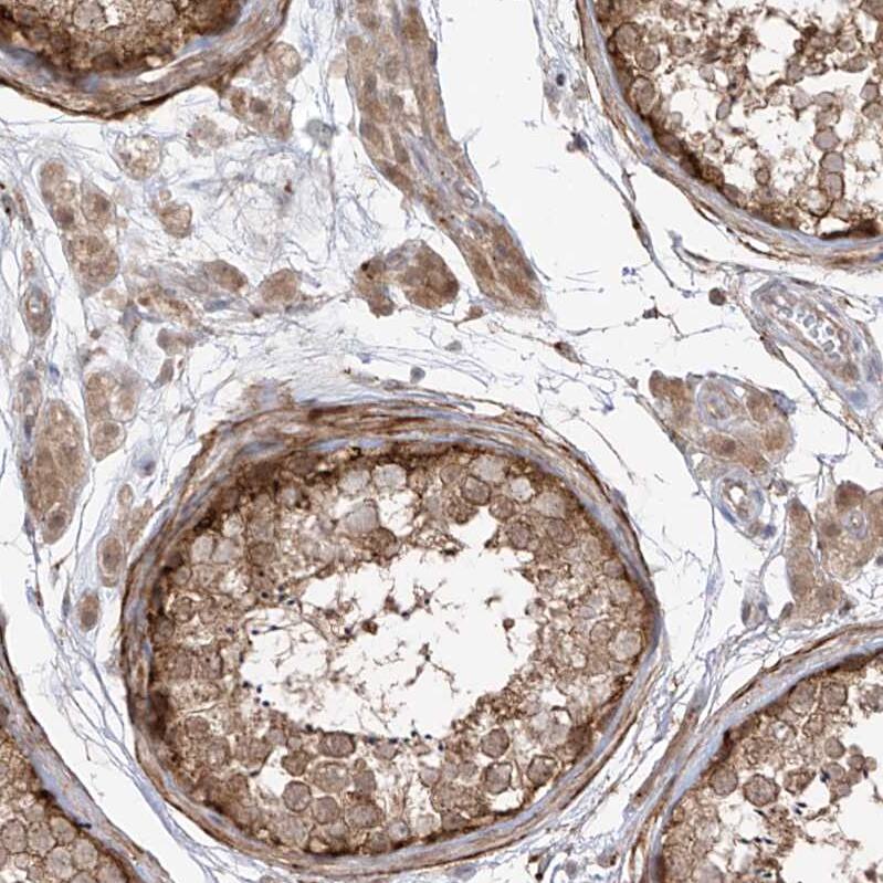 PDE11A Antibody - BSA Free Immunohistochemistry-Paraffin: PDE11A Antibody - BSA Free [NBP1-85919]