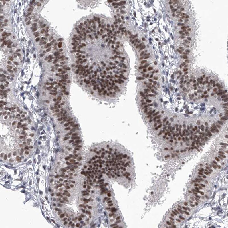 PPIL4 Antibody - BSA Free Immunohistochemistry-Paraffin: PPIL4 Antibody - BSA Free [NBP1-85921]