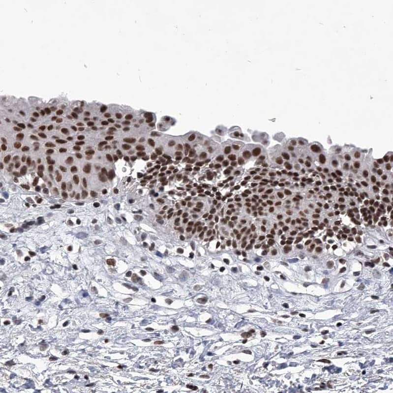 PPIL4 Antibody - BSA Free Immunohistochemistry-Paraffin: PPIL4 Antibody - BSA Free [NBP1-85921]