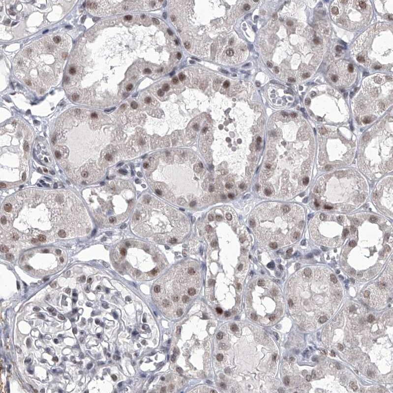 PPIL4 Antibody - BSA Free Immunohistochemistry-Paraffin: PPIL4 Antibody - BSA Free [NBP1-85921]