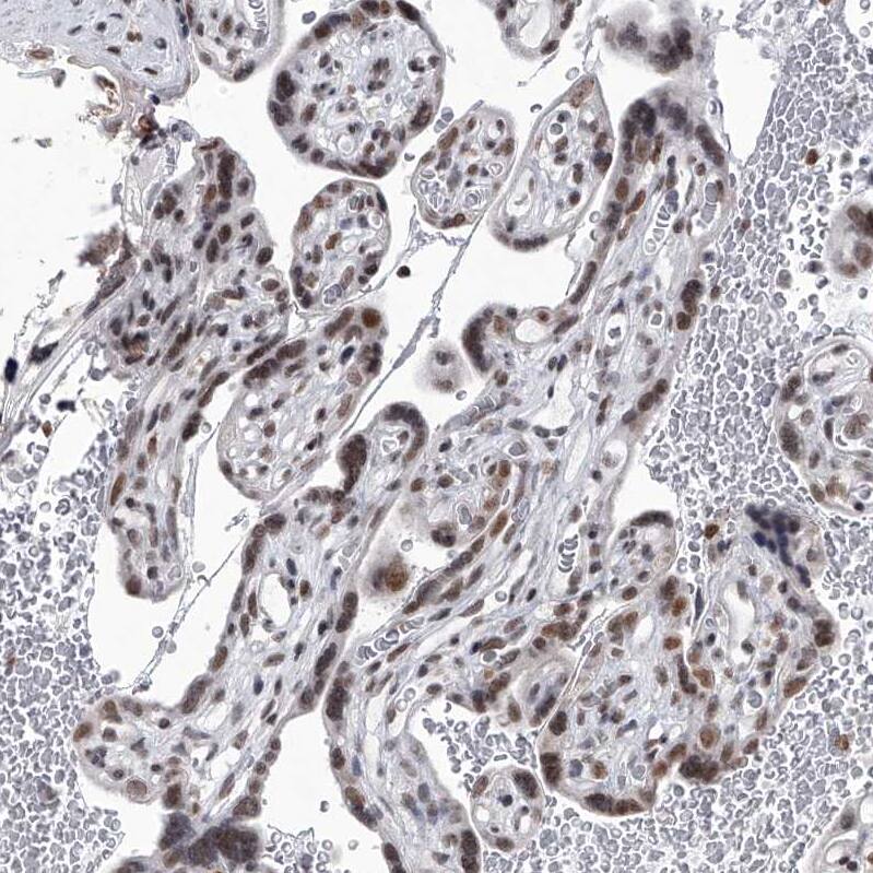 PPIL4 Antibody - BSA Free Immunohistochemistry-Paraffin: PPIL4 Antibody - BSA Free [NBP1-85921]