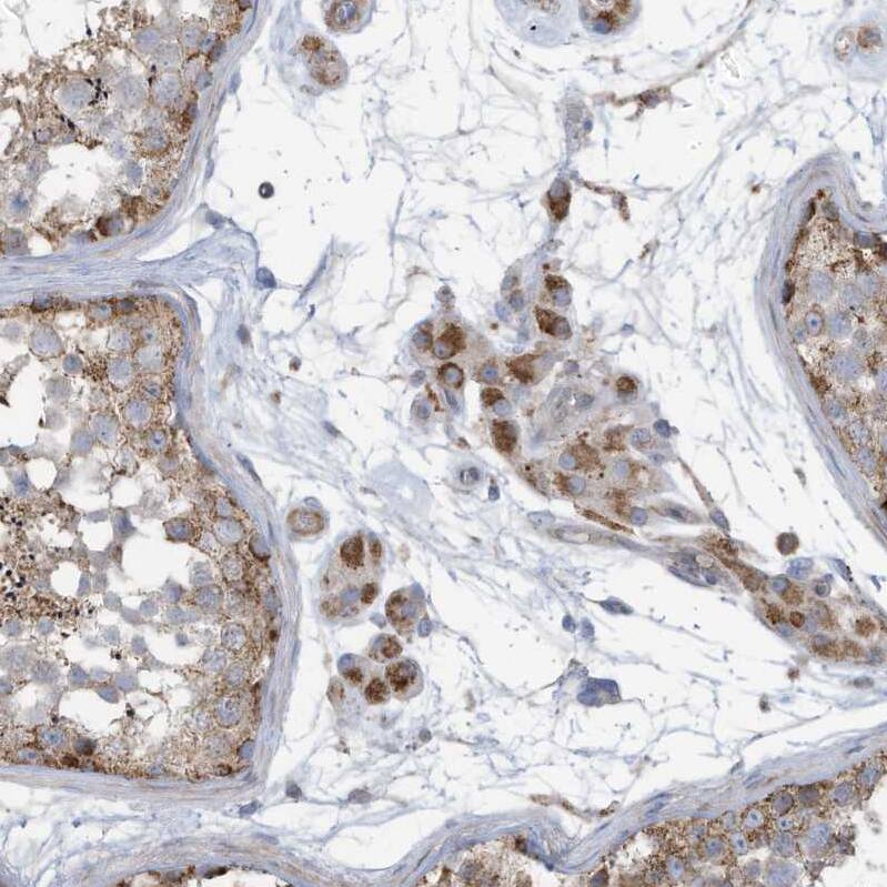 GTPBP2 Antibody - BSA Free Immunohistochemistry-Paraffin: GTPBP2 Antibody [NBP1-85924]
