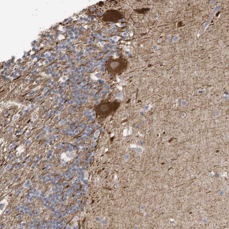 GTPBP2 Antibody - BSA Free Immunohistochemistry-Paraffin: GTPBP2 Antibody [NBP1-85924]