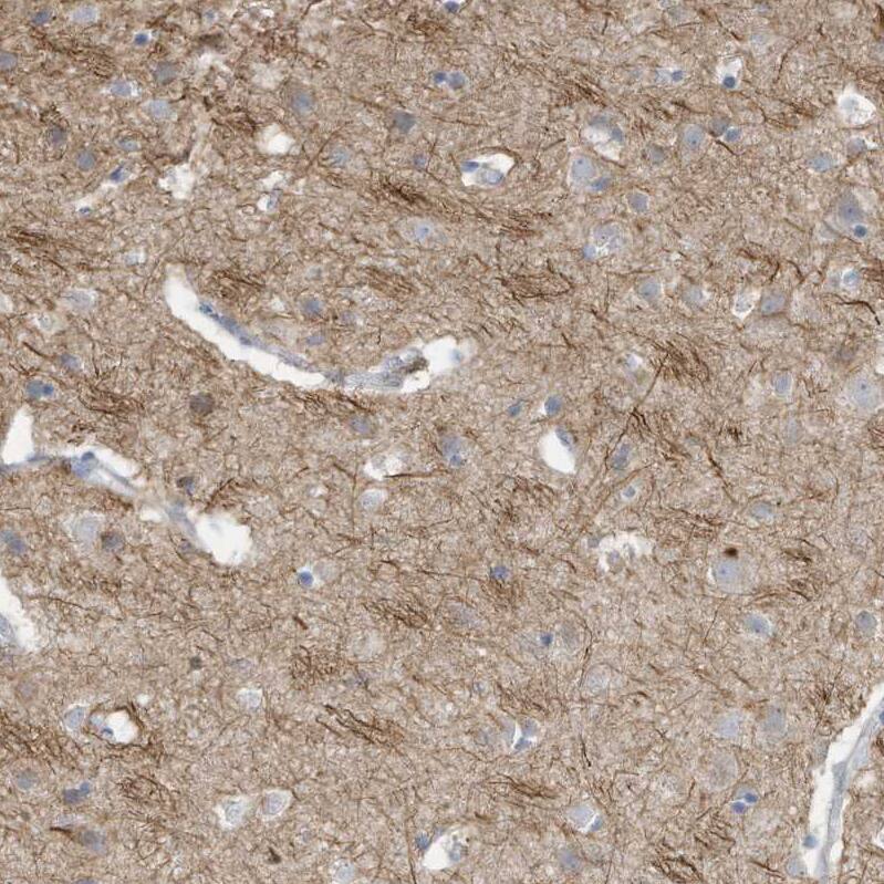GTPBP2 Antibody - BSA Free Immunohistochemistry-Paraffin: GTPBP2 Antibody [NBP1-85924]