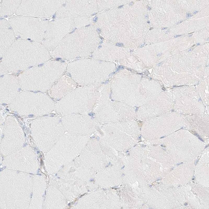 PGD Antibody - BSA Free Immunohistochemistry-Paraffin: PGD Antibody [NBP1-85925]