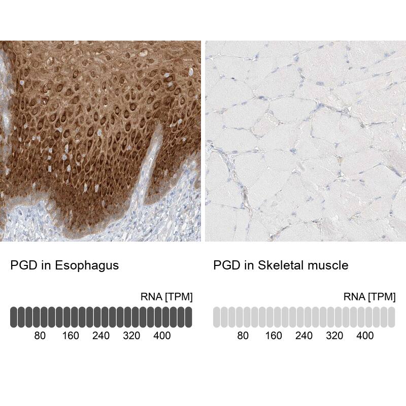 PGD Antibody - BSA Free Immunohistochemistry-Paraffin: PGD Antibody [NBP1-85925]