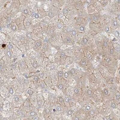 PGD Antibody - BSA Free Immunohistochemistry-Paraffin: PGD Antibody [NBP1-85925]