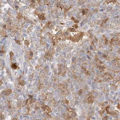 PGD Antibody - BSA Free Immunohistochemistry-Paraffin: PGD Antibody [NBP1-85925]