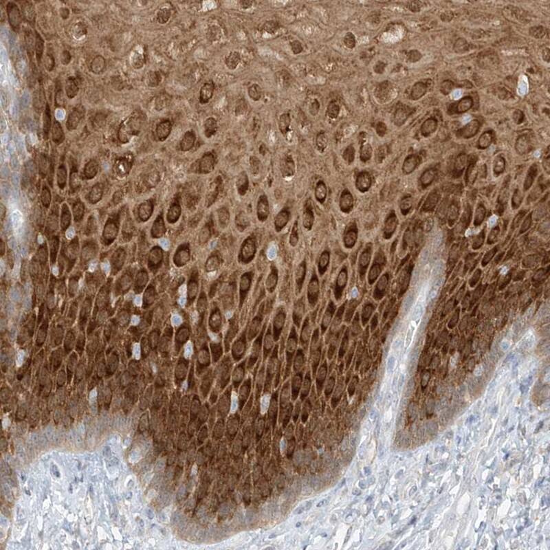 PGD Antibody - BSA Free Immunohistochemistry-Paraffin: PGD Antibody [NBP1-85925]