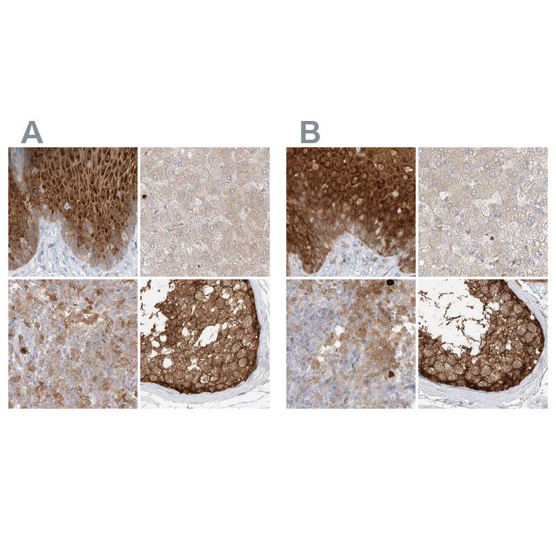 PGD Antibody - BSA Free Immunohistochemistry-Paraffin: PGD Antibody [NBP1-85925]