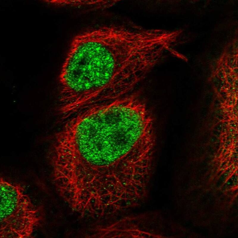 KLHL17 Antibody - BSA Free Immunocytochemistry/ Immunofluorescence: KLHL17 Antibody [NBP1-85926]