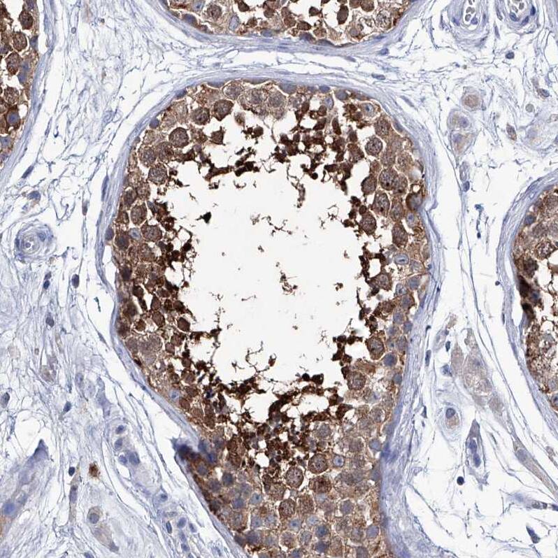 KLHL17 Antibody - BSA Free Immunohistochemistry-Paraffin: KLHL17 Antibody - BSA Free [NBP1-85926]