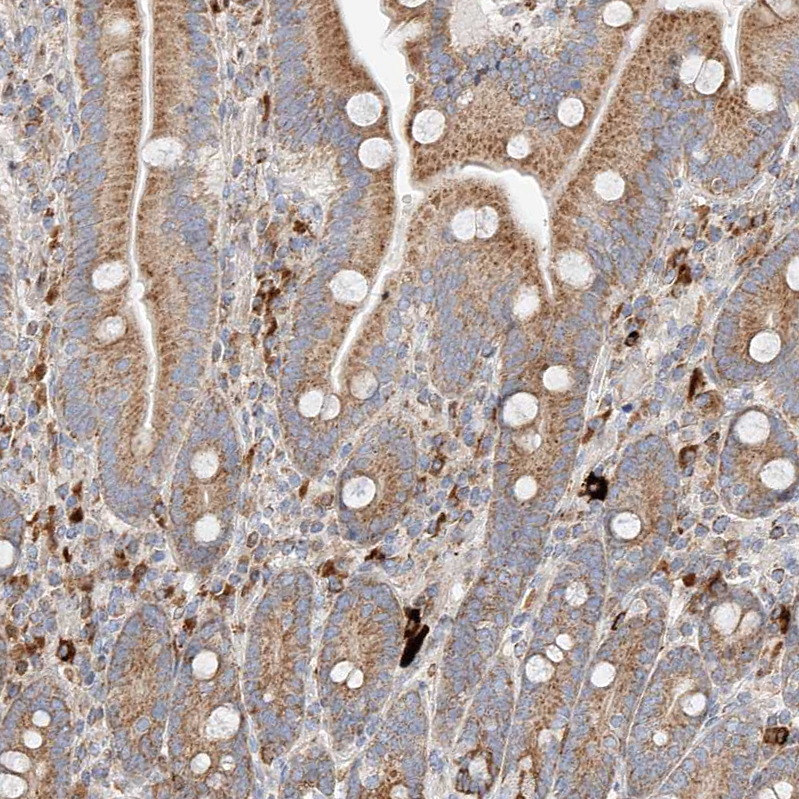 OSGEPL1 Antibody - BSA Free Immunohistochemistry-Paraffin: OSGEPL1 Antibody - BSA Free [NBP1-85928]