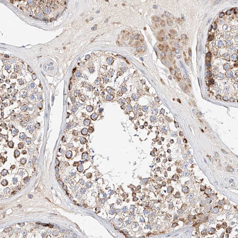 OSGEPL1 Antibody - BSA Free Immunohistochemistry-Paraffin: OSGEPL1 Antibody - BSA Free [NBP1-85928]