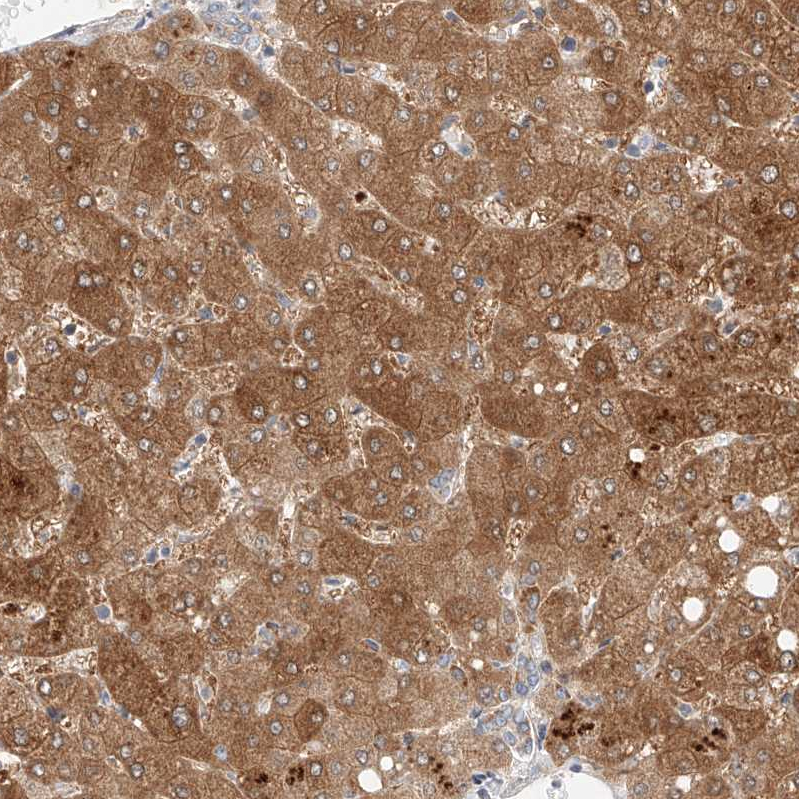 OSGEPL1 Antibody - BSA Free Immunohistochemistry-Paraffin: OSGEPL1 Antibody - BSA Free [NBP1-85928]