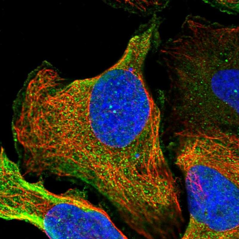 ZNF227 Antibody - BSA Free Immunocytochemistry/ Immunofluorescence: ZNF227 Antibody [NBP1-85930]