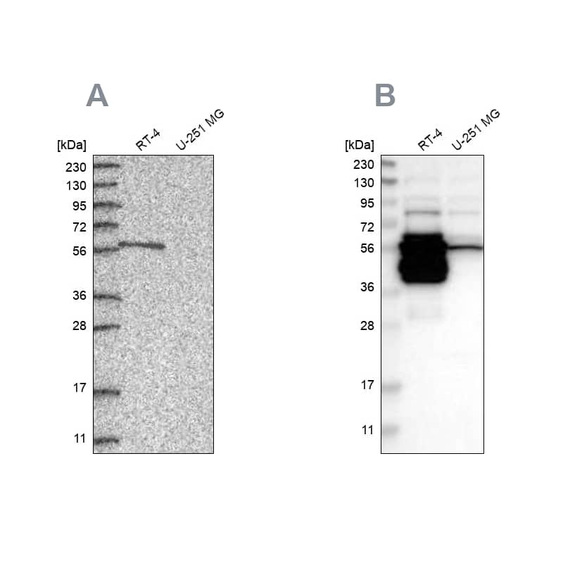 BAIAP2L1 Antibody - BSA Free Western Blot: BAIAP2L1 Antibody - BSA Free [NBP1-85940]