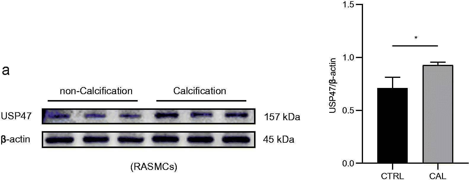 USP47 Antibody - BSA Free