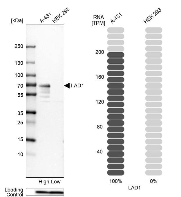 LAD1 Antibody - BSA Free Western Blot: LAD1 Antibody - BSA Free [NBP1-85945]