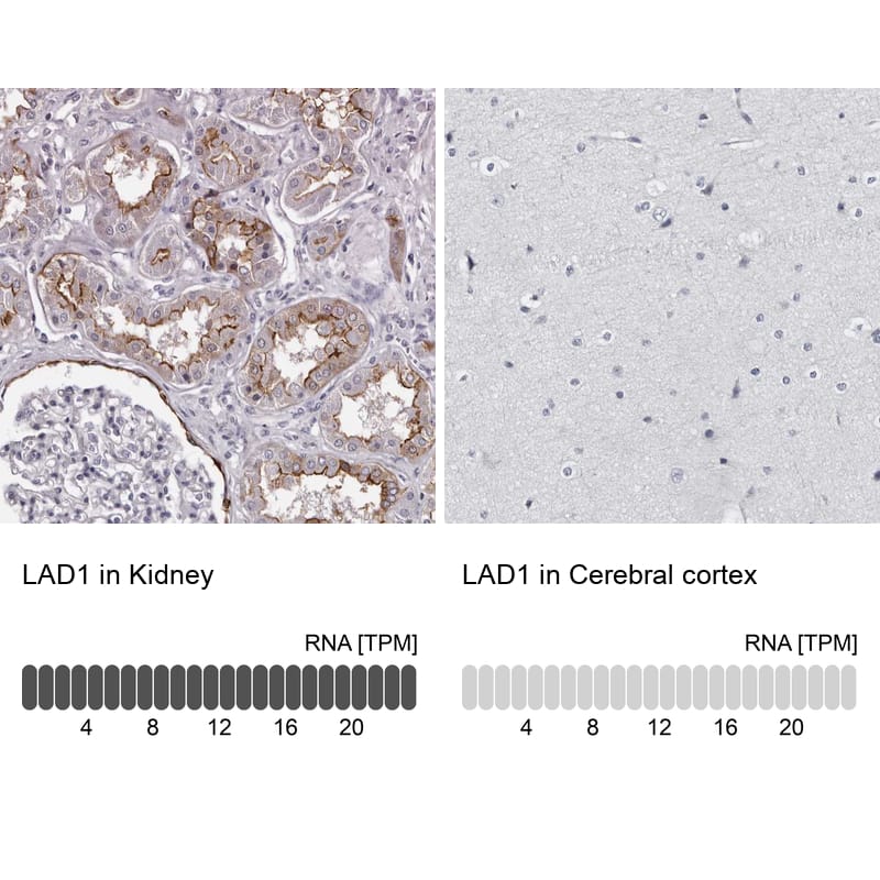 LAD1 Antibody - BSA Free Immunohistochemistry-Paraffin: LAD1 Antibody - BSA Free [NBP1-85945]