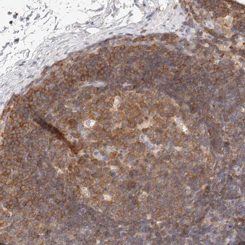 CSK Antibody - BSA Free Immunohistochemistry-Paraffin: CSK Antibody - BSA Free [NBP1-85951]