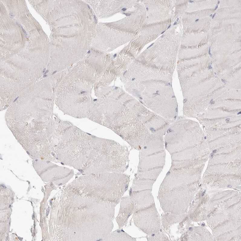 CSK Antibody - BSA Free Immunohistochemistry-Paraffin: CSK Antibody - BSA Free [NBP1-85951]