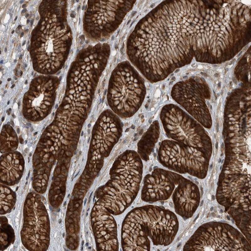 RABGGTB Antibody - BSA Free Immunohistochemistry-Paraffin: RABGGTB Antibody [NBP1-85957]